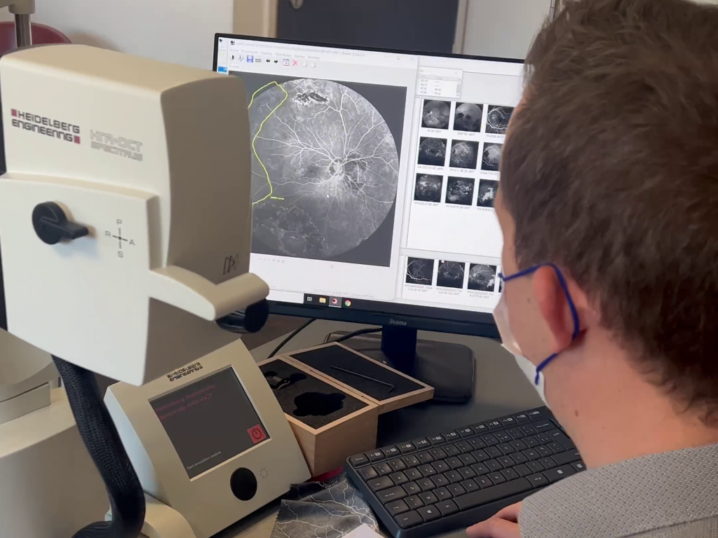 Comment Se Passe Une Angiographie De Loeil